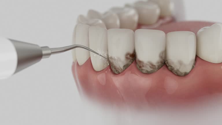 Trusted Teeth Whitening service in Howland Center, OH - Dentist Open Now